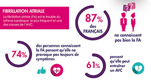 fibrillation-atriale-122014.jpg
